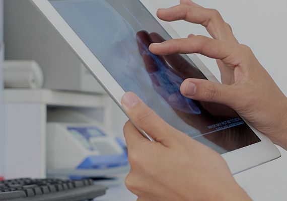 تحديد المتطلبات